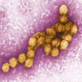 West Nile Virus (Photo Credit: Cynthia Goldsmith)